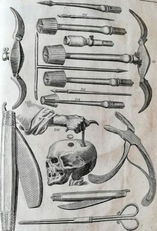 A page from The Surgeon's Mate (1639), an instruction manual for medical treatment aboard a ship, that depicts trepanation and tools for surgery